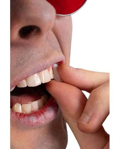 Eckzähne in Sichtverpackung Eckzähne in Sichtverpackung