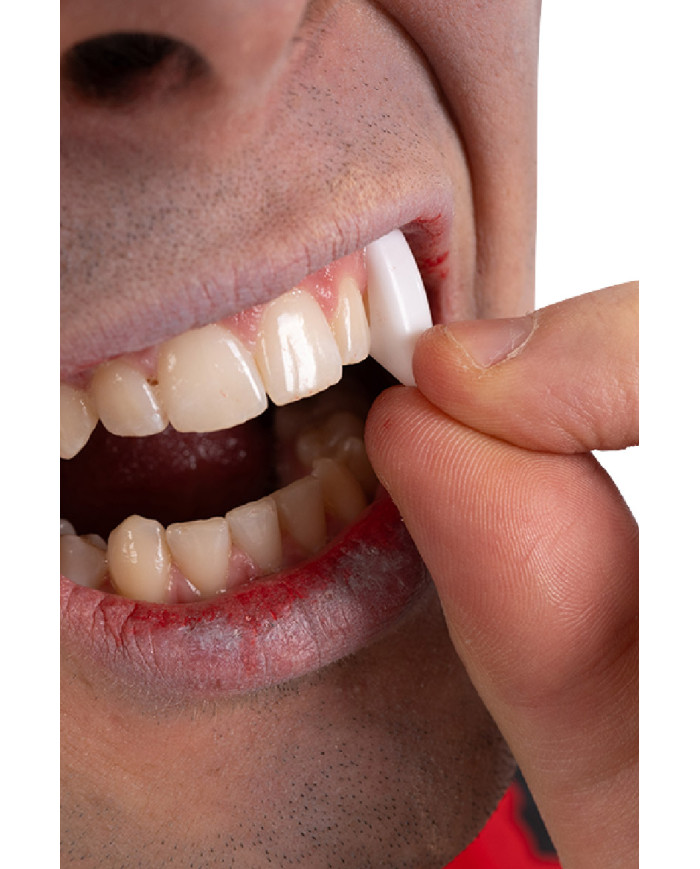 Denti canini in blister