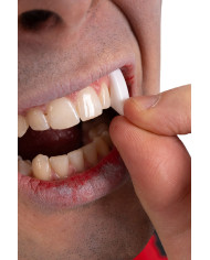 Canine teeth in blister